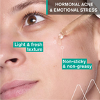Uriage Hyseac Skin Anti-Blemish Serum 5.8% AHA for Hormonal Peak & Stress Acne
