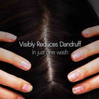 Kapiva Ayurveda Hair Rituals Neem Triphaladi Shampoo for Dandruff Control