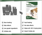 Urban Yog Acne Pimple Patch - Limited Time Offer