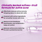 PLIX The Plant Fix 2% Salicylic Acid Jamun Active Acne Control Dewy Serum For Active Acne & Dark Spot Reduction
