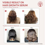 Ivory Natural Serum For Growth Of Hair For New Hair Roots & Encouraging Growth Of Hair