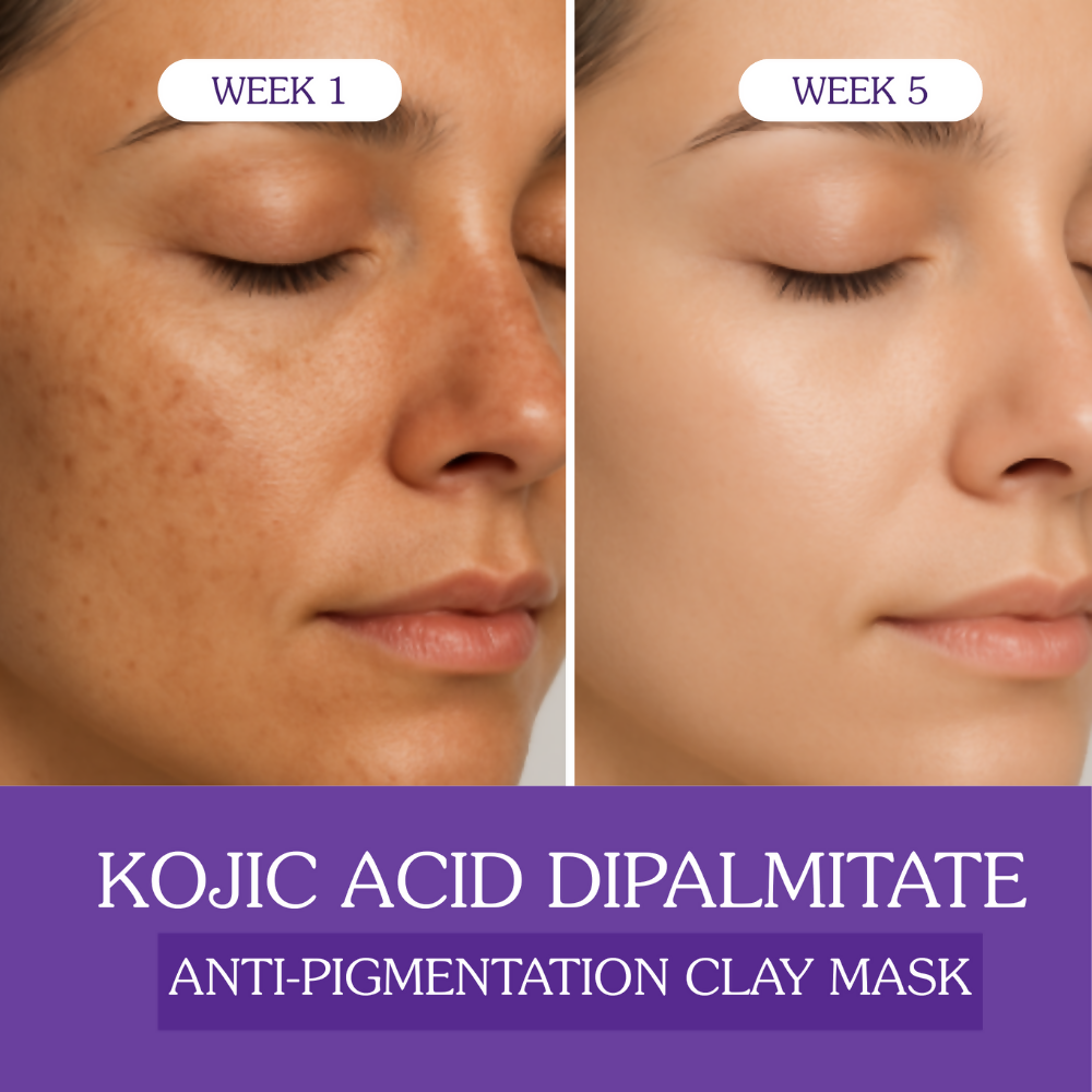 Bake Kojic Acid Anti-Pigmentation Clay Mask