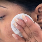 House of Beauty Anti Pimple Wipes
