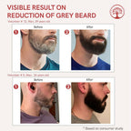 Ivory Natural Greys Beard Serum Restore Natural Black Color Of Grey White Beard - Distacart
