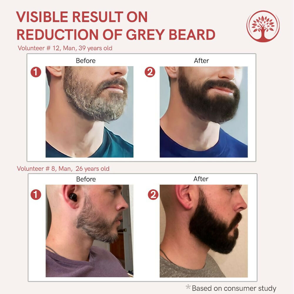 Ivory Natural Greys Beard Serum Restore Natural Black Color Of Grey White Beard - Distacart
