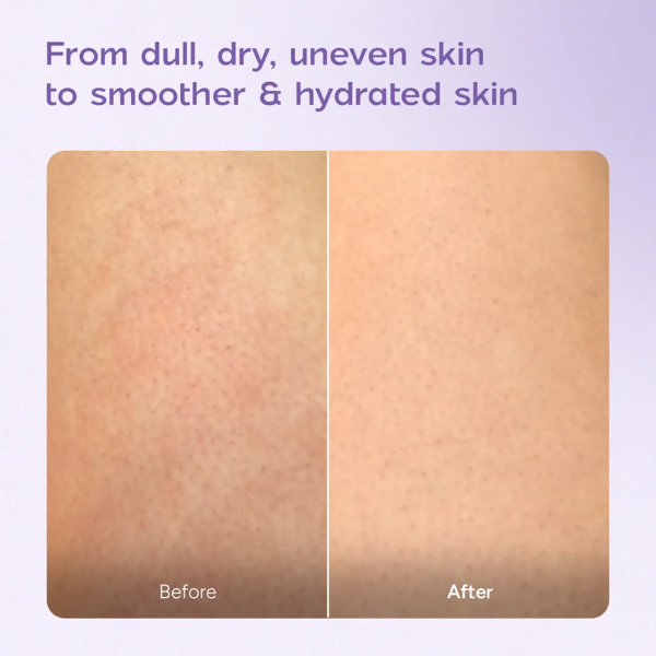 Arata Niacinamide Body Milk for Dull and Dehydrated Skin
