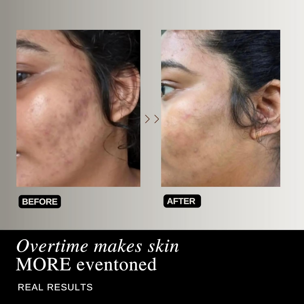 The Formularx Air Brush Facial All In One Lactic Acid Serum For Instant Radiance