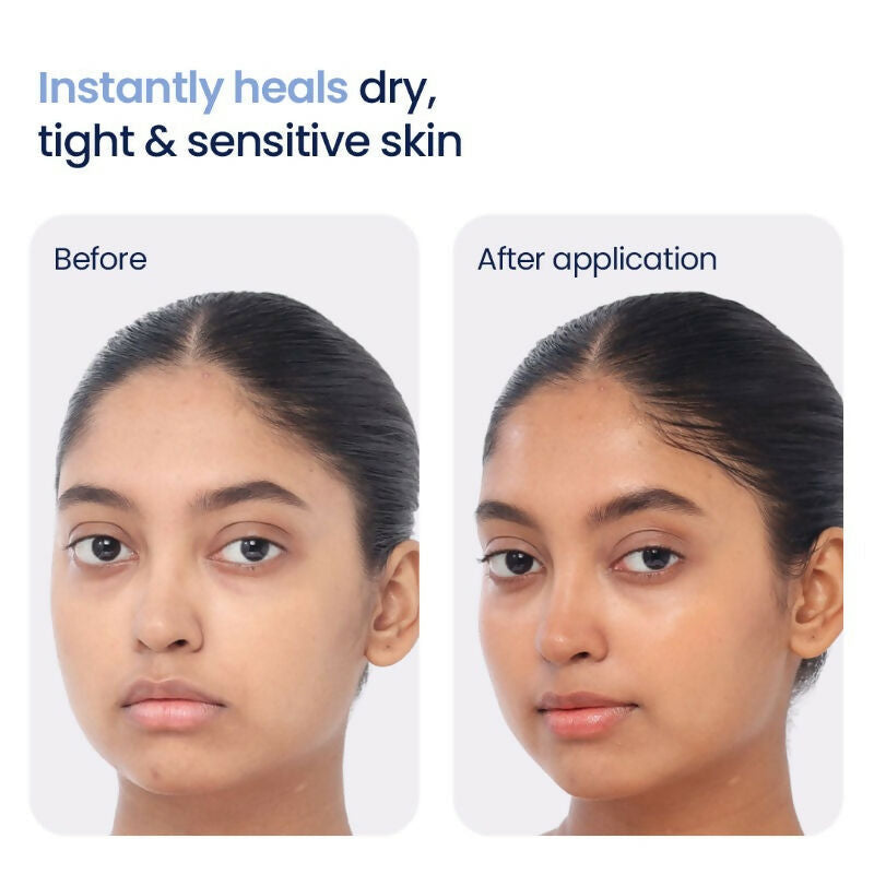 Wishcare 3:1:1 Barrier Bounce Moisturizer with Non-Comedogenic - Distacart