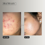 The Formularx Barrier Relief Ceramide Lightweight Moisturizer With Niacinamide & Hyaluronic Acid