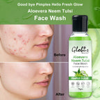 Globus Remedies Aloe vera Neem Tulsi Enriched With Glycerin & Oil Control Formula