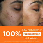 Light Up Vitamin C Face Cream For Pigmentation Ageing And Collagen