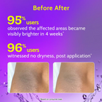 Chemist at Play Roll On Serum For Neck Knee & Elbow