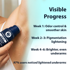 Dermistry AHA Kojic Acid Licorice Niacinamide Underarms Lightening Deodorant Roll On Serum Dark Spots Pigmentation - Distacart
