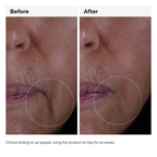 The Ordinary Growth Factors Solution 15% Serum