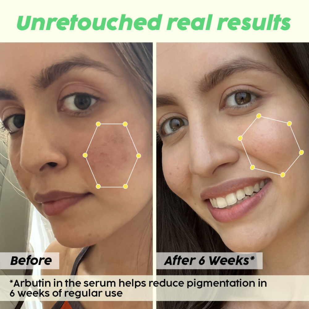 PLIX The Plant Fix Underarm Depigmentation Serum Spray & 2% Alpha Arbutin Face Serum