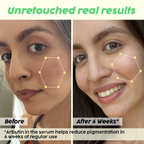 PLIX The Plant Fix Underarm Depigmentation Serum Spray & 2% Alpha Arbutin Face Serum