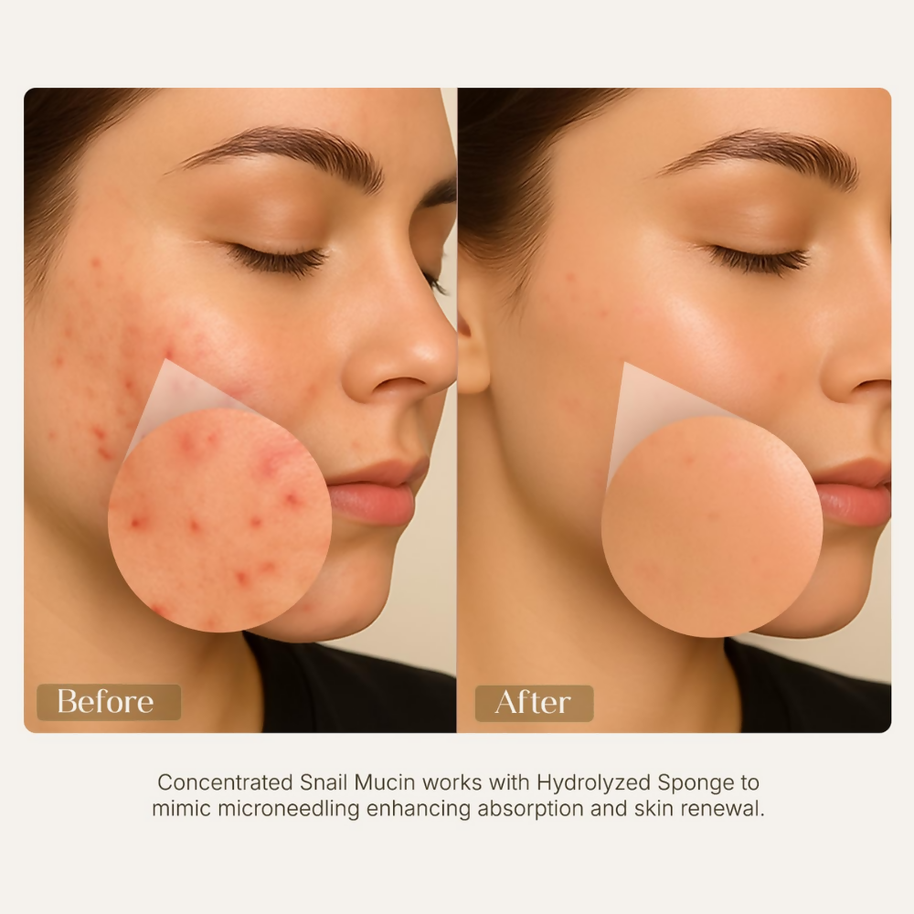 Seoulskin Snail Mucin Micro-needling Serum 7500 PPM - Distacart