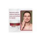 Sabates Pimple Acne Cream For Acne-Prone, Rough & Bumpy Skin