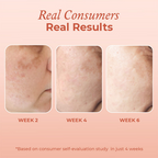 The Pink Foundry Dark Spot & Hyperpigmentation Face Serum