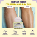 Sanfe Eczema Soap For Very Very Dry Skin