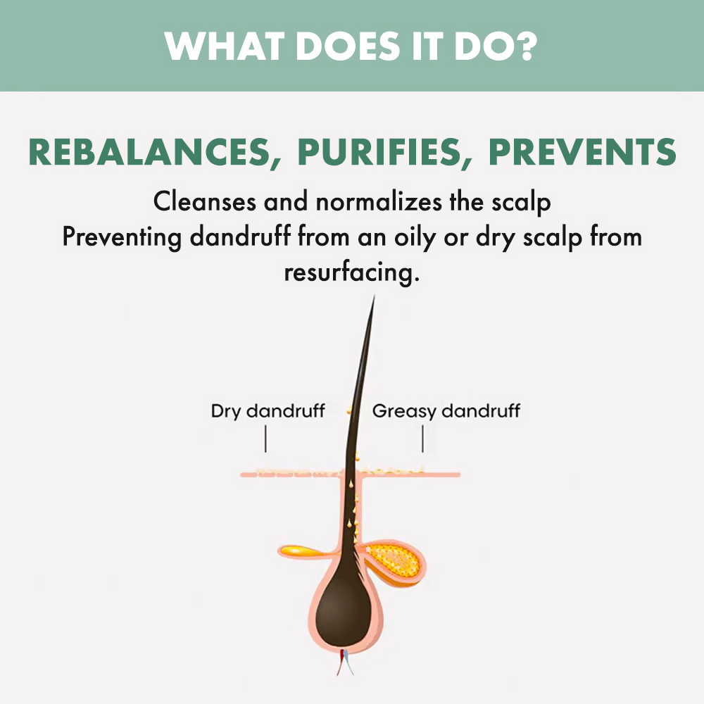 Alfaparf Milano Scalp Rebalance Purifying Shampoo Reduces Dandruff