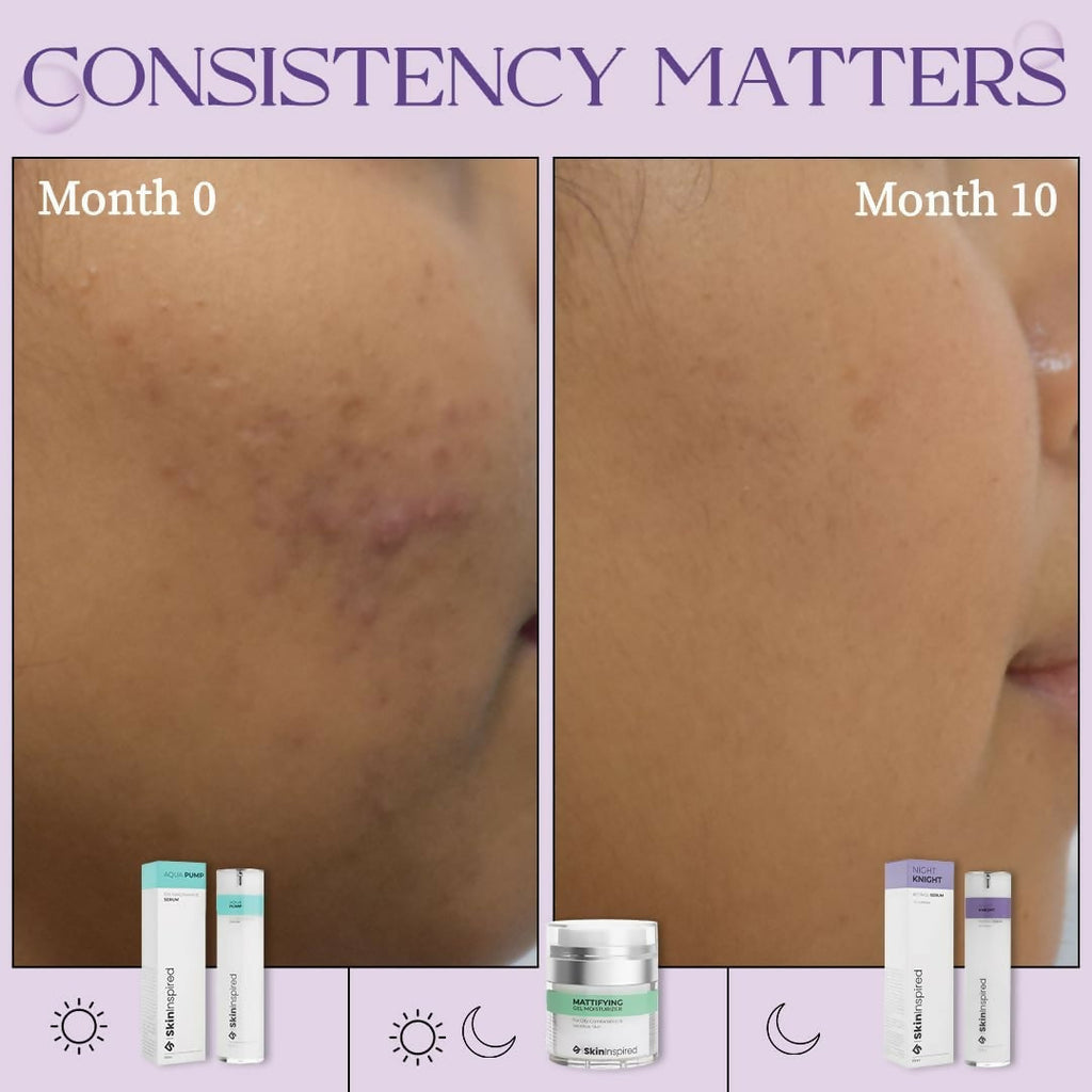 SkinInspired Retinol Face Serum (2% vitAlease) - Distacart