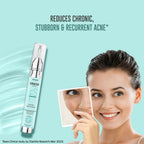 Dermafique Acne Avert Spot Corrector Face Serum