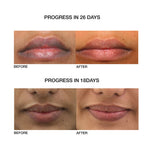 Skog Lip Repair Oil