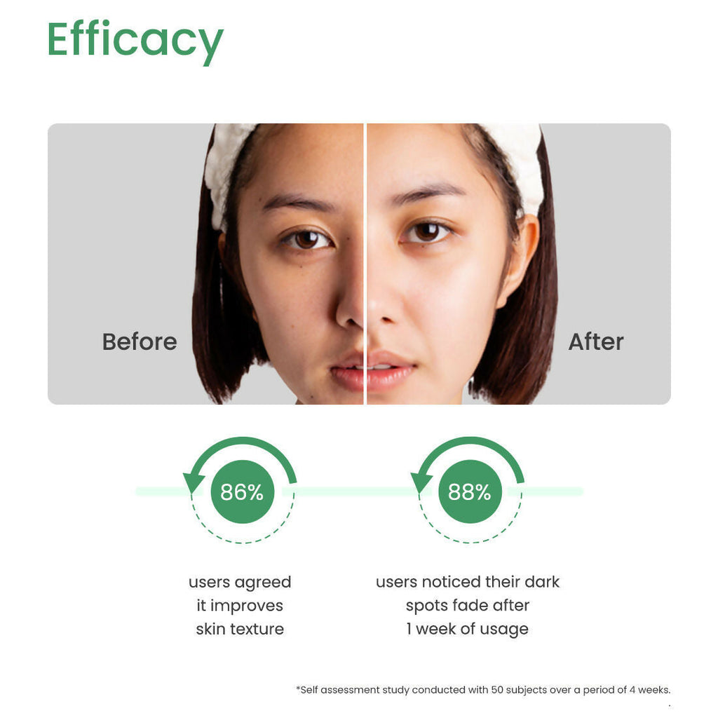 Earth Rhythm 10% Azelaic Acid Acne Control Face Serum
