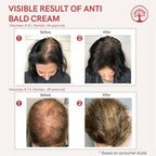 Ivory Natural Grey Combo For Hair - Natural Solution For Greys, Restore Natural Black And Shine Of Hair
