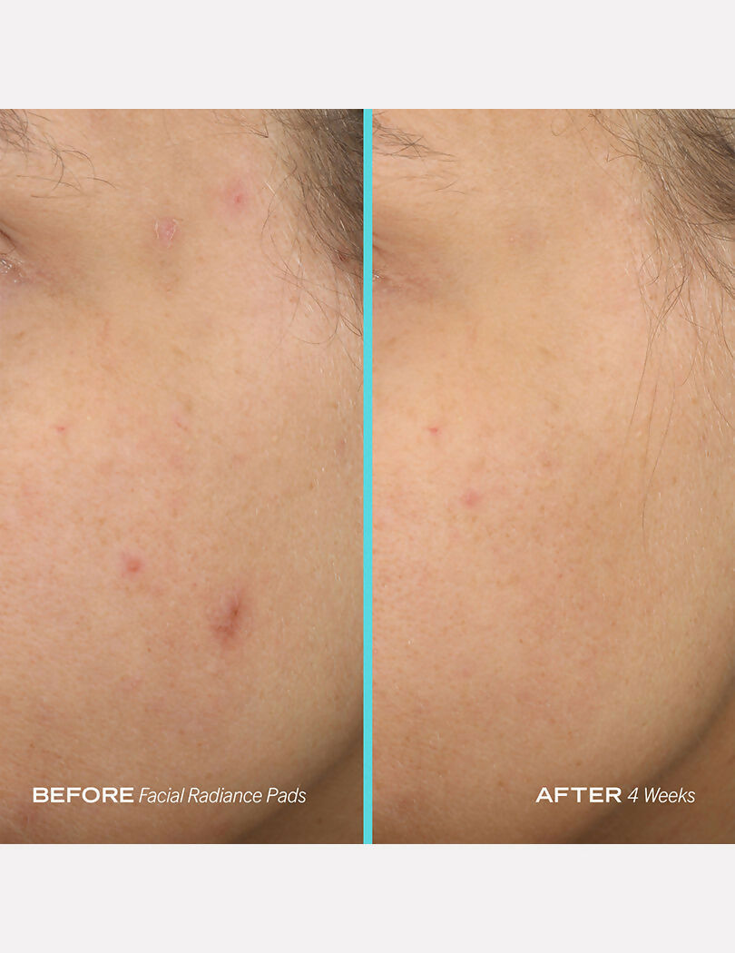 First Aid Beauty Facial Radiance Pads