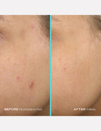 First Aid Beauty Facial Radiance Pads