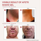 Ivory Natural After Shave Gel For Gentle Post-Shave, Reduced Facial Worries