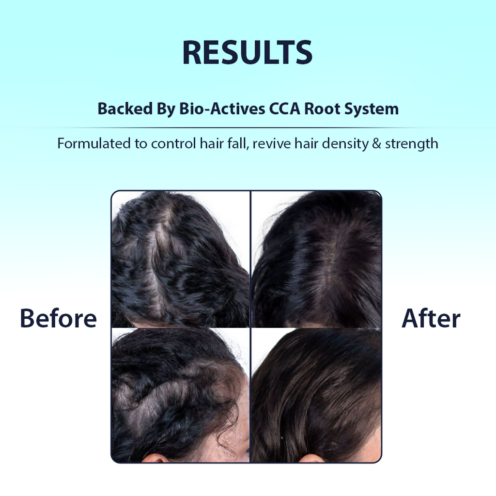 Dermistry Caffeine Collagen Protein Anti-Hair Fall Control Mask & Serum
