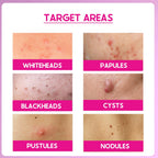 Cos-IQ ABP 33% Strong Exfoliating Peel