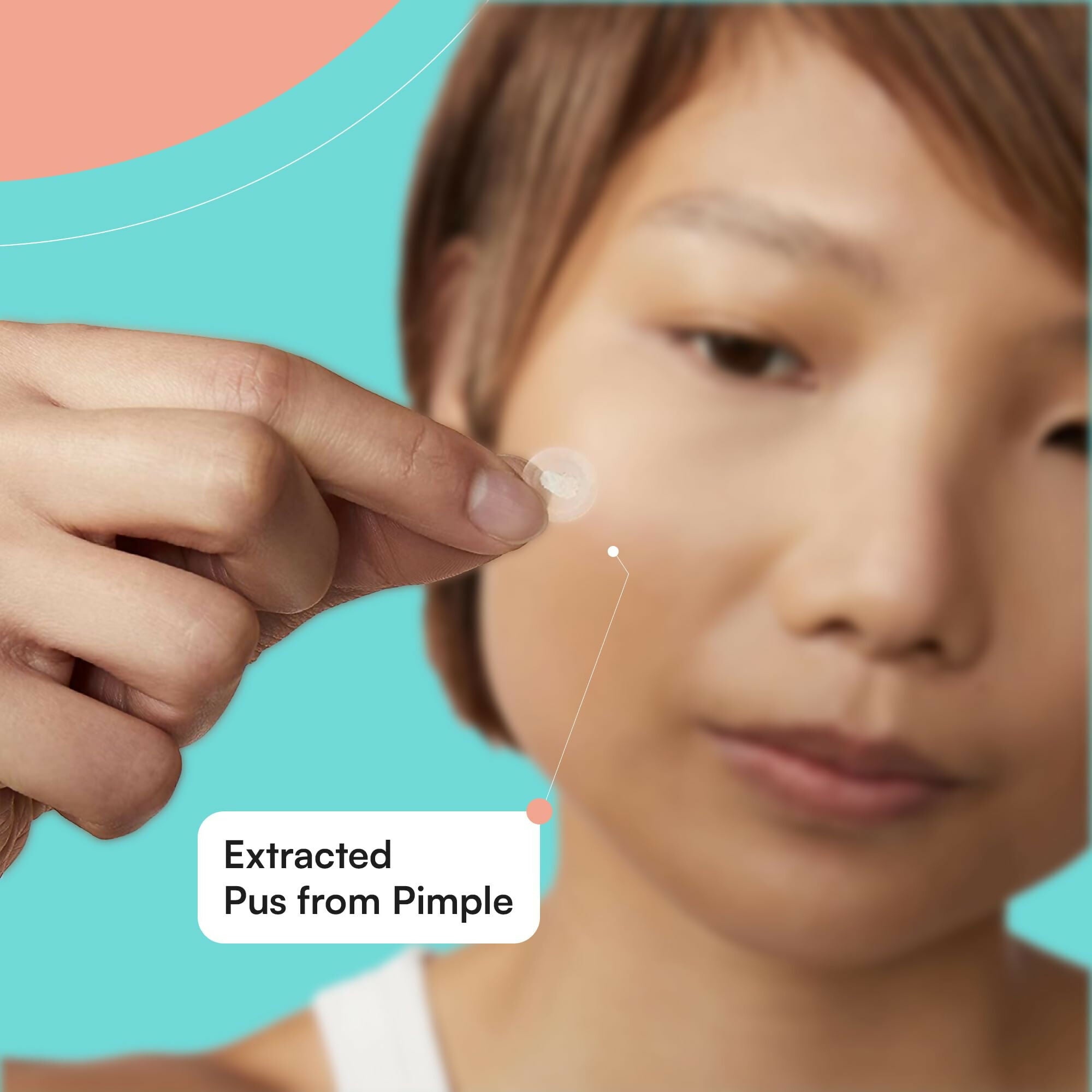 Xokit Pimple Patches for Face, Hydrocolloid Acne Patch for Acne Treatment - Invisible Facial Stickers Covers