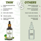 The Natural Wash Salicylic Acid Face Serum