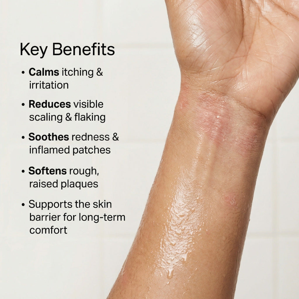 VedicDerm Sensitive Skin Bundle for Psoriasis, Eczema, Atopic Dermatitis - Distacart
