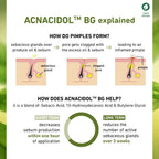 Plum Green Tea & 3% Zinc Complex Face Serum with Acnacidol BG - Fights Acne, Pimples & Controls Oil