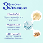 Blue Heaven Acne Clear Serum with 5% Azelaic Acid +1% Salicylic Acid + 0.5% Nutmeg Oil