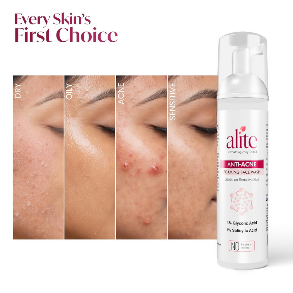Alite Anti Acne 5-in-1 Foaming Face Wash with 4% Glycolic Acid & 1% Salicylic Acid - Distacart