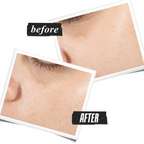 Kiehl's Ultra Pure High-Potency Serum with 1.5% Hyaluronic Acid