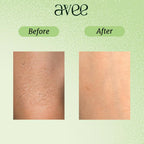 Avee Kids Daily Body Lotion for Kids 5-12 Yrs with Oats, Vitamins B5 & E, Shea & Cocoa Butter, Non-Greasy, Deep Hydration