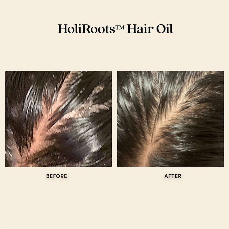 Fable & Mane HoliRoots Oil To Strengthen Roots and Thicken Hair