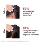 Professional O3+ Women Densiderm Hair Growth Scalp Serum Spray For Anti Hair Loss With Ginseng