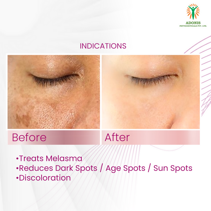 Adonis Ad Mela Tx Cream - Distacart