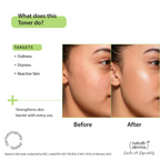 Nature Derma Hyaluronic Acid Toner Essence