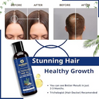 Moolveda 100% Pure Rosemary Hair Oil for Hair Growth