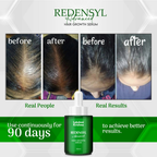 Lakshmi Krishna Naturals Redensyl Advanced Hair Growth Serum - Distacart