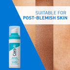 CeraVe Resurfacing Retinol Serum, Reduces Acne Marks with Licorice Root Extract & Niacinamide
